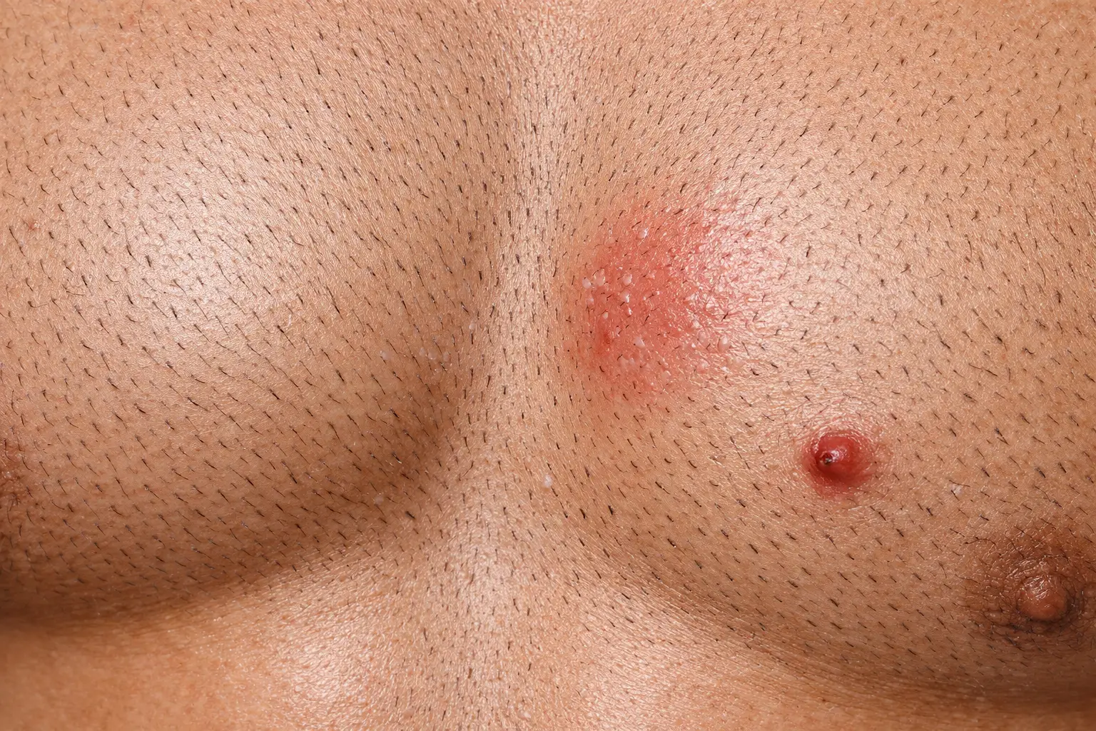 The Chest Shaving Cons